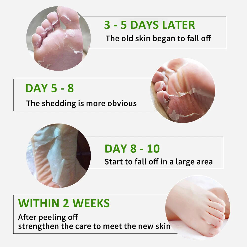 FlowWeek Exfoliating Foot Mask-Skin Exfoliating Foot Mask For Dry,Chapped Feet,Calluses,Dead Skin Remover, Exfoliant
