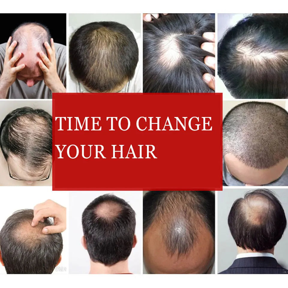 Short wigs for men's male black wig synthetic natural hair for young man balding sparse hair crew cut hair style PAGEUP