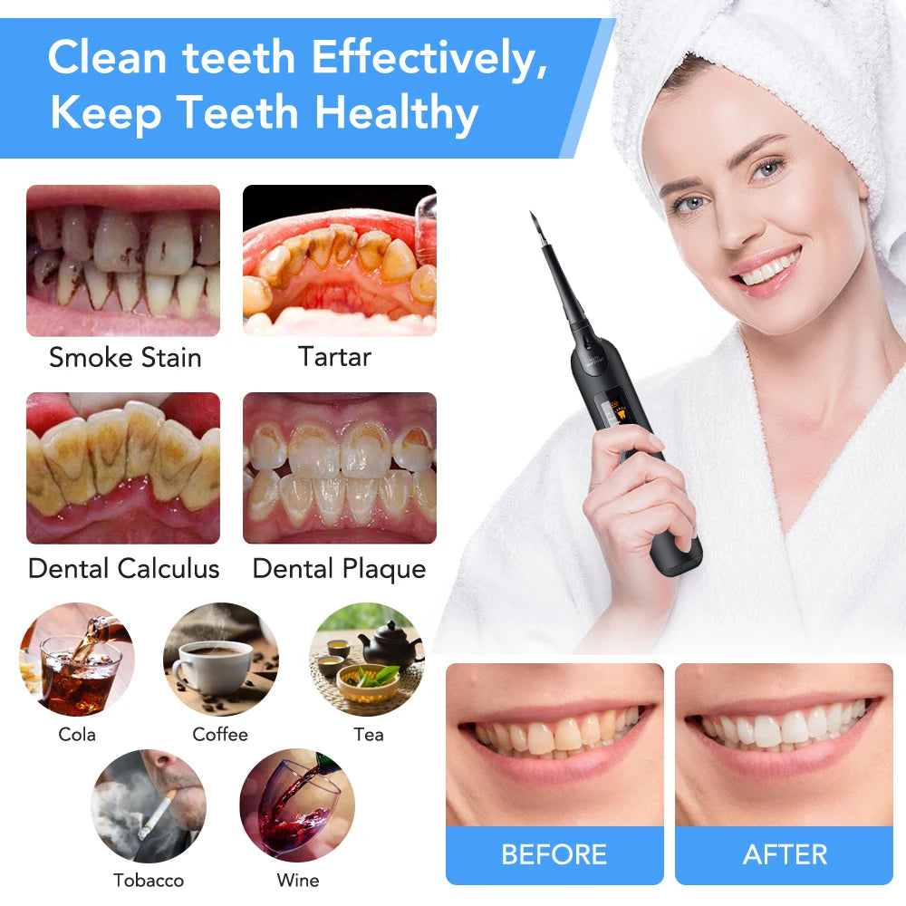 Home Calculus Remover Dental Scaling Electric Scaler Sonic Smoke Stains Tartar Plaque Teeth Whitening Dental Scaler