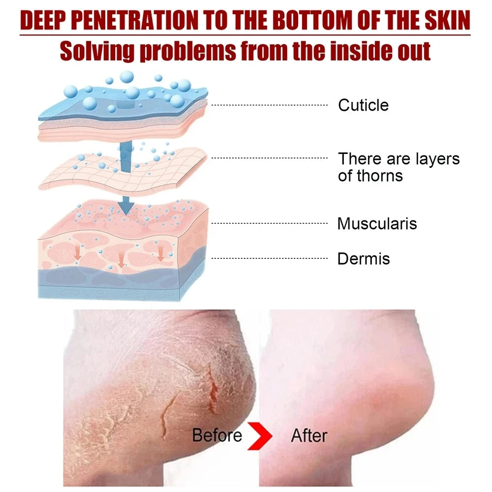 Foot Peeling Mask Peeling Foot Mask Repairs Heels & Removes Dry Dead Skin Feet Exfoliating Foot Peel Mask for Dry Cracked Feet