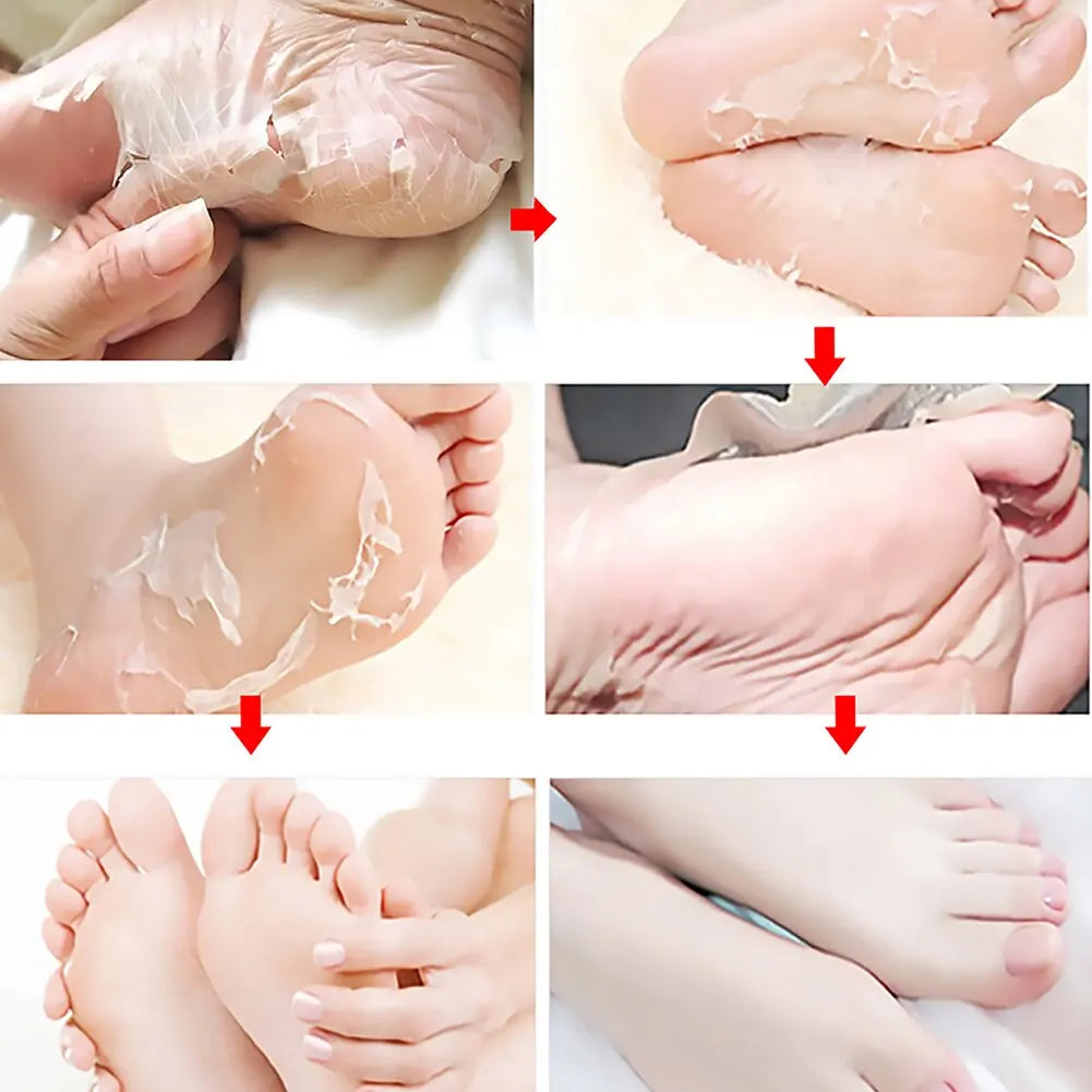 FlowWeek Exfoliating Foot Mask-Skin Exfoliating Foot Mask For Dry,Chapped Feet,Calluses,Dead Skin Remover, Exfoliant