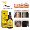 Ginger Hair Growth Serum Anti Hair Loss Baldness Fast Regrowth Hair Care Oil Repair Damaged Hair Scalp Treatment For Women Men