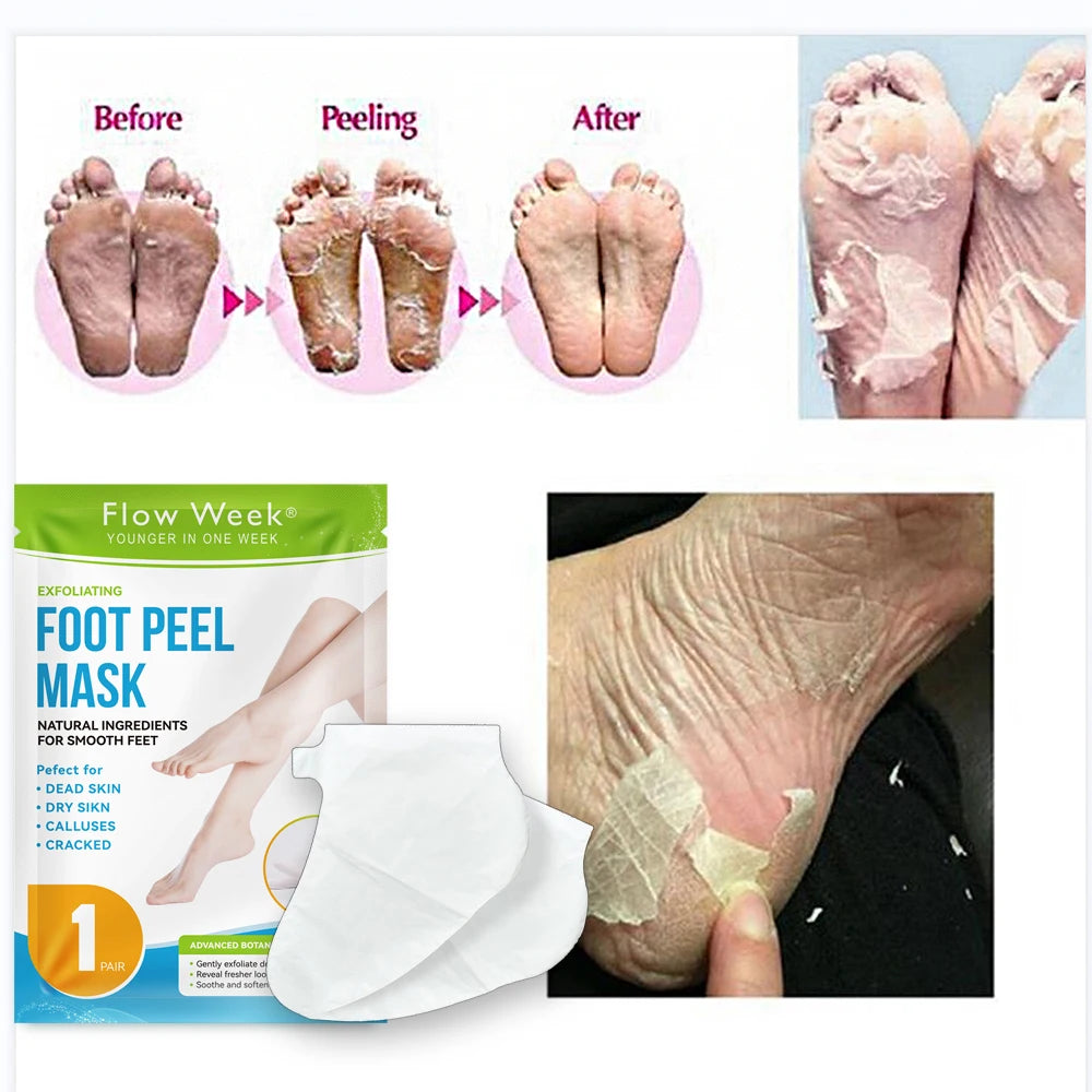 FlowWeek Exfoliating Foot Mask-Skin Exfoliating Foot Mask For Dry,Chapped Feet,Calluses,Dead Skin Remover, Exfoliant
