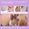 FlowWeek Exfoliating Foot Mask-Skin Exfoliating Foot Mask For Dry,Chapped Feet,Calluses,Dead Skin Remover, Exfoliant