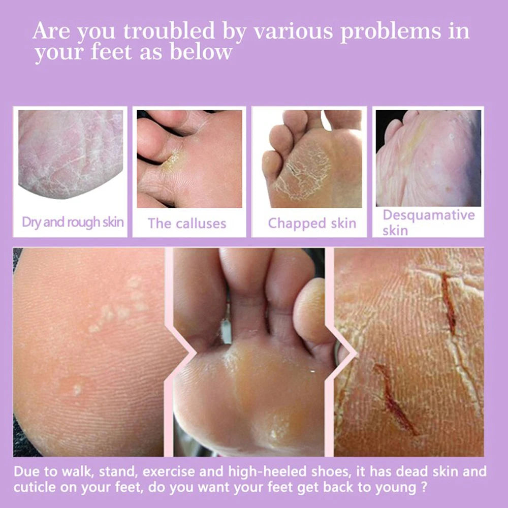 FlowWeek Exfoliating Foot Mask-Skin Exfoliating Foot Mask For Dry,Chapped Feet,Calluses,Dead Skin Remover, Exfoliant
