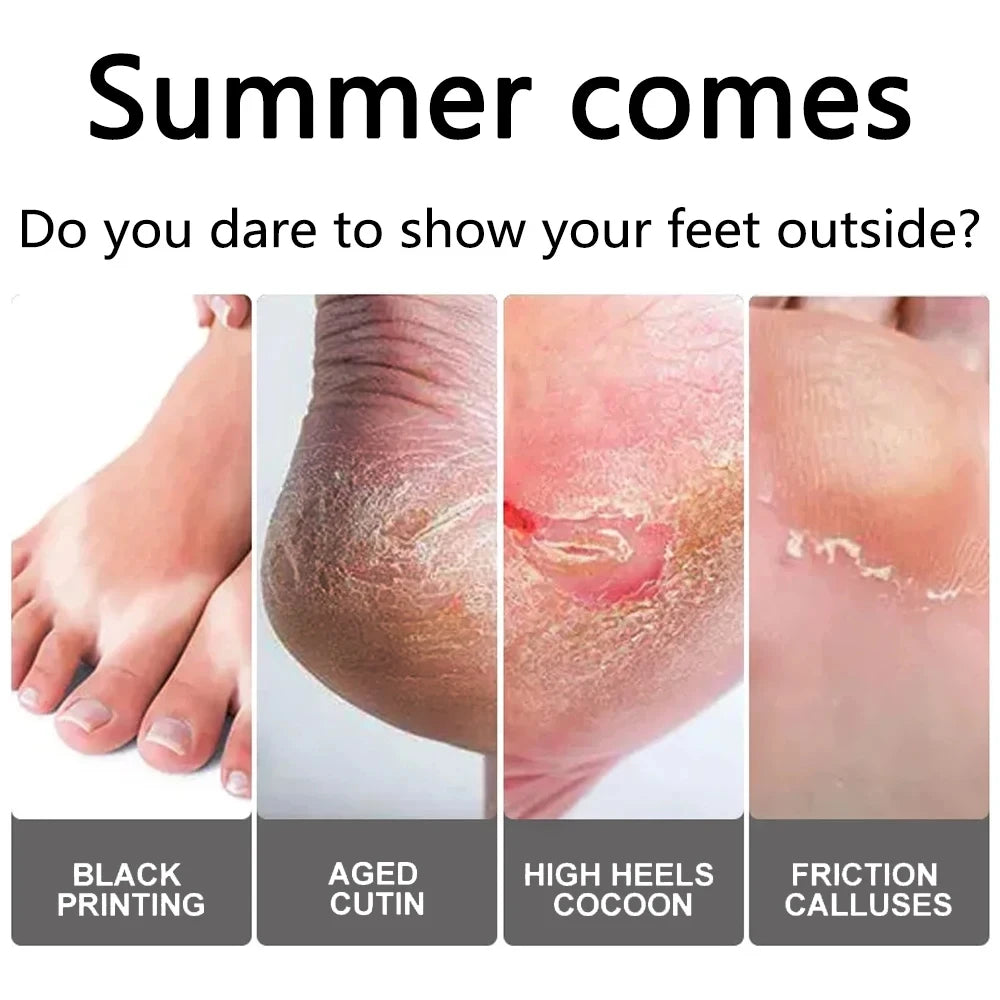 Foot Peeling Mask Peeling Foot Mask Repairs Heels & Removes Dry Dead Skin Feet Exfoliating Foot Peel Mask for Dry Cracked Feet