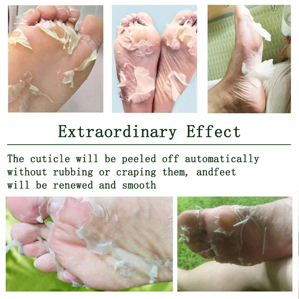 Foot Peeling Mask Peeling Foot Mask Repairs Heels & Removes Dry Dead Skin Feet Exfoliating Foot Peel Mask for Dry Cracked Feet