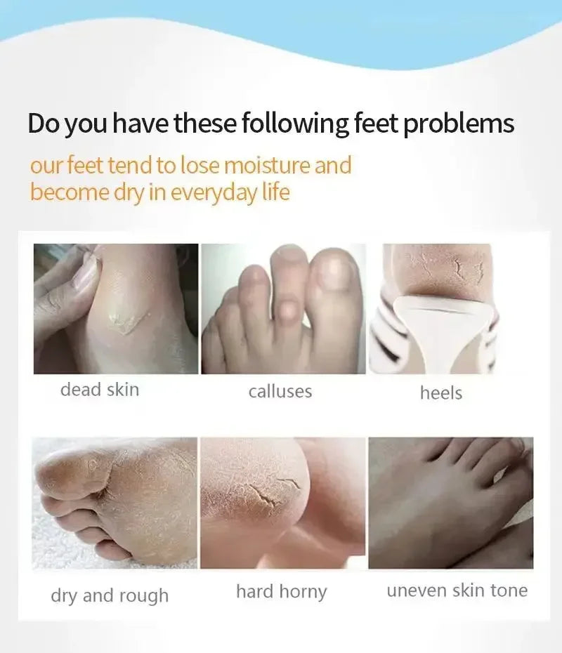 1 Pag = 1 Pair Honey Foot Mask For Remove Dead Skin Calluses Exfoliating Foot Mask Feet Cream Whitening Foot Spa Skin Care Tool