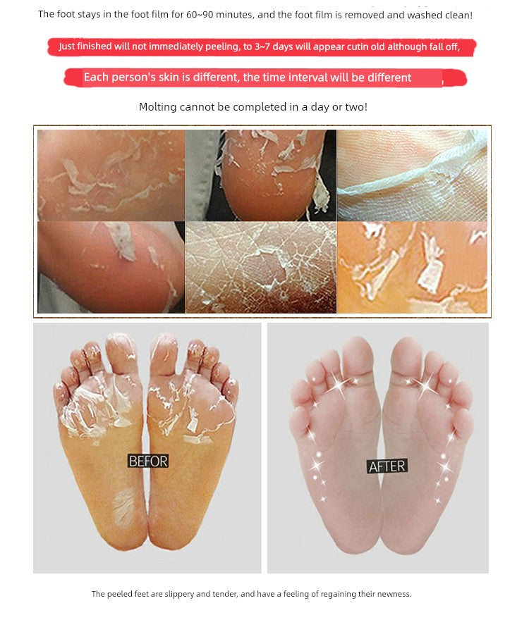 South Korea Die Enjia Double Exfoliating Dead Skin Calluses Moisturizing Foot Mask Tender White Feet Sole Care Tender Foot Mask