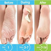 1 Pag = 1 Pair Honey Foot Mask For Remove Dead Skin Calluses Exfoliating Foot Mask Feet Cream Whitening Foot Spa Skin Care Tool