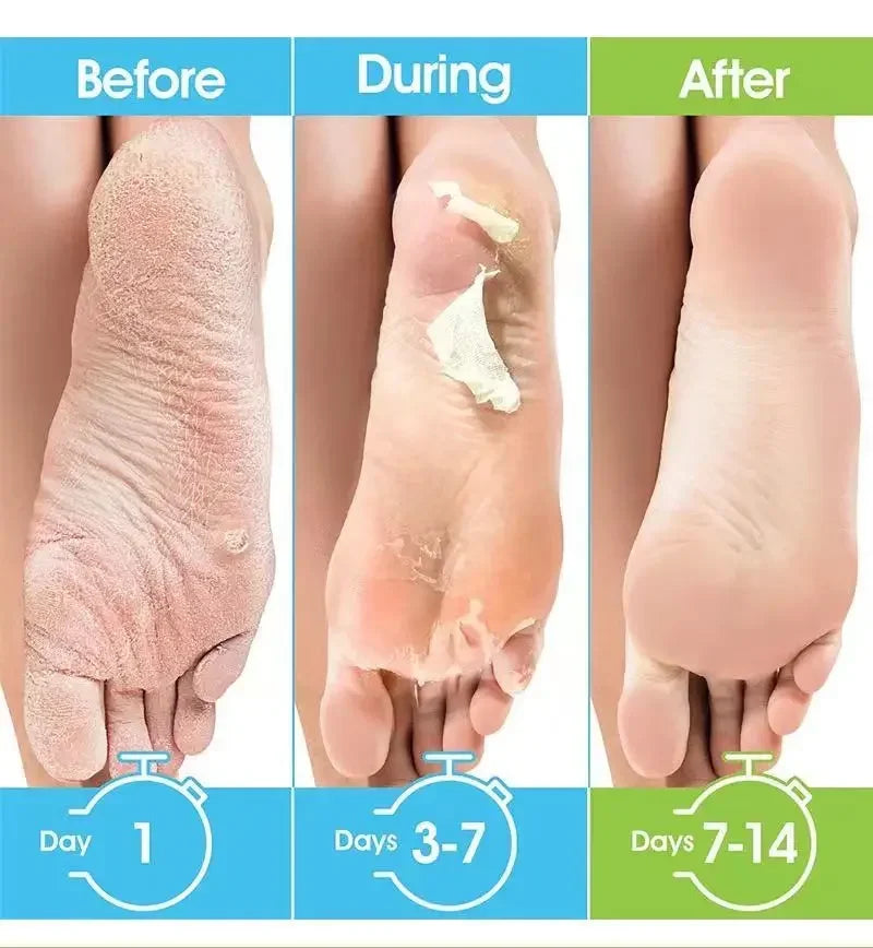 1 Pag = 1 Pair Honey Foot Mask For Remove Dead Skin Calluses Exfoliating Foot Mask Feet Cream Whitening Foot Spa Skin Care Tool