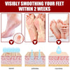 Foot Peeling Mask Peeling Foot Mask Repairs Heels & Removes Dry Dead Skin Feet Exfoliating Foot Peel Mask for Dry Cracked Feet
