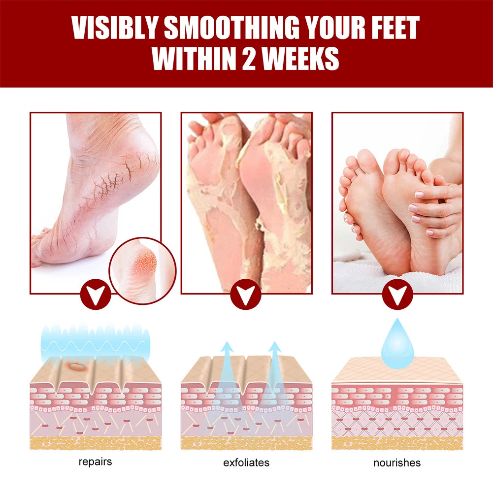 Foot Peel Mask, Exfoliating Peel Off Calluses Dead Skin Callus Remover Dry Cracked Feet, Baby Soft Smooth Touch Feet Skin