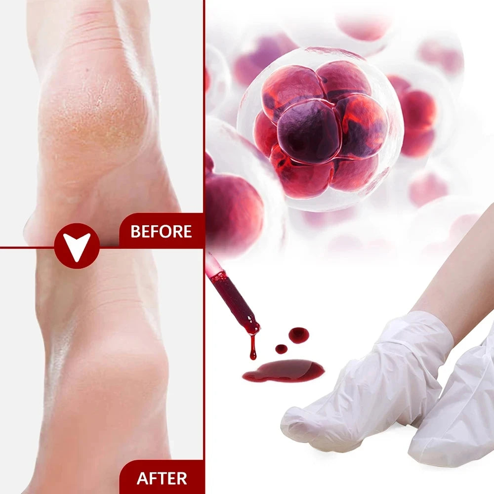 Foot Peeling Mask Peeling Foot Mask Repairs Heels & Removes Dry Dead Skin Feet Exfoliating Foot Peel Mask for Dry Cracked Feet