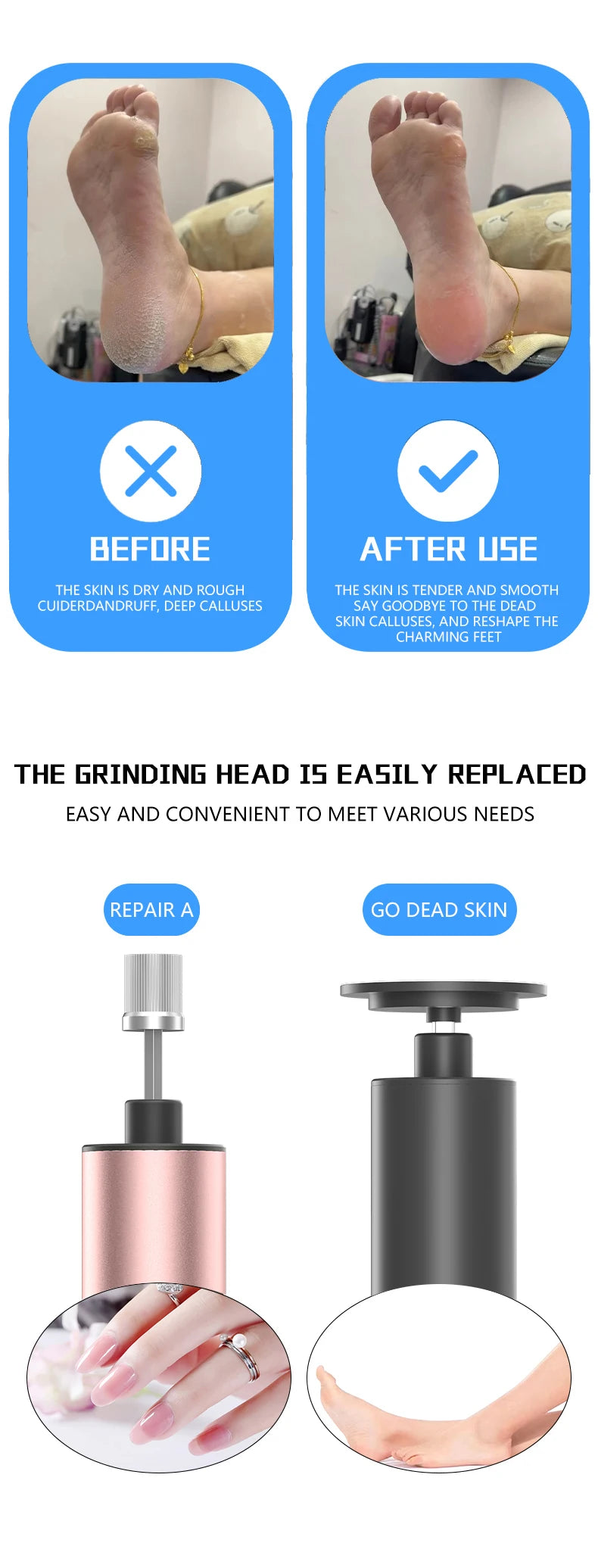 Foot Care File Electric Foot Callus Remover Leg Heels Remove Dead Skin Pedicure Tool Set and Replacement Sandpaper