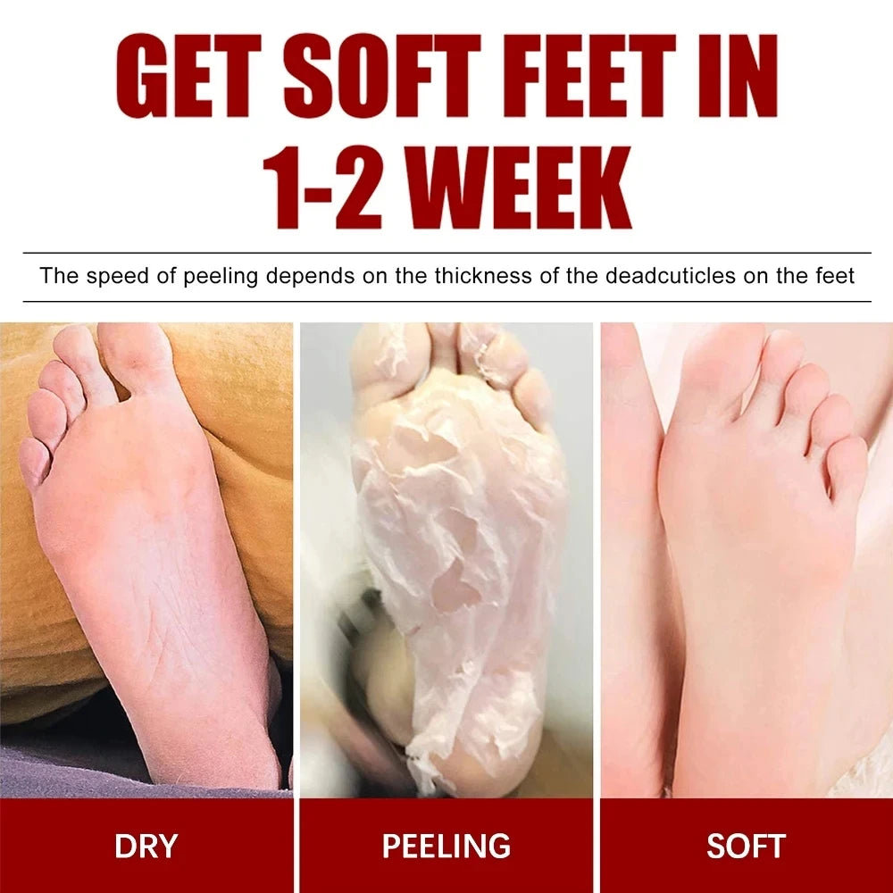 Foot Peeling Mask Peeling Foot Mask Repairs Heels & Removes Dry Dead Skin Feet Exfoliating Foot Peel Mask for Dry Cracked Feet