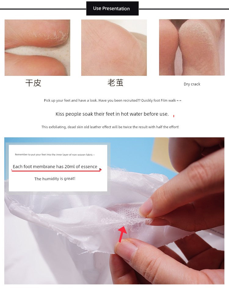 South Korea Die Enjia Double Exfoliating Dead Skin Calluses Moisturizing Foot Mask Tender White Feet Sole Care Tender Foot Mask